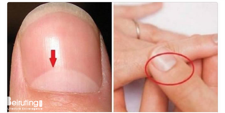 Beiruting - Life Style Blog - Do You Know What the Semicircle on Your Nails  Indicates