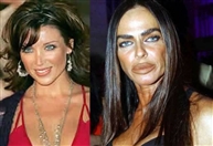 Around the World Social Event Celebrity plastic surgery before and after Lebanon