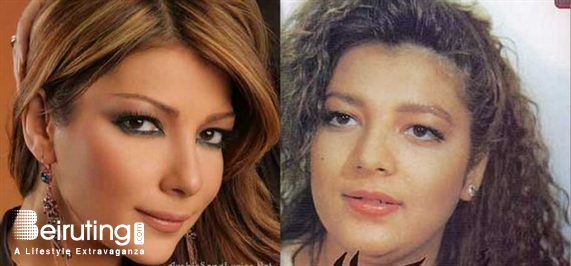 Social Event Arab Celebrities Before After Lebanon